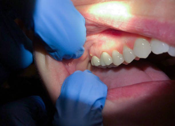 Best Same-Day Emergency Dental Services in South Wallins, KY