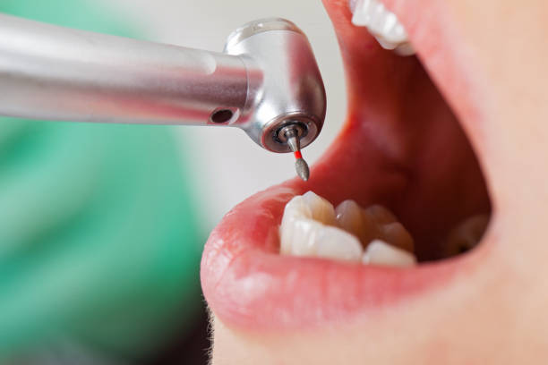 Best Emergency Gum Treatment in South Wallins, KY